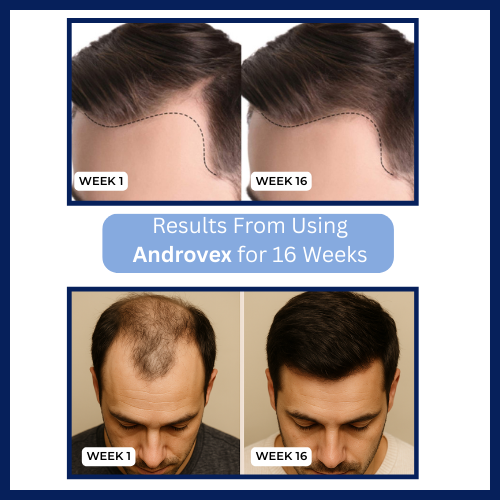 Androvex™ Copper Peptide Hair Growth Formula