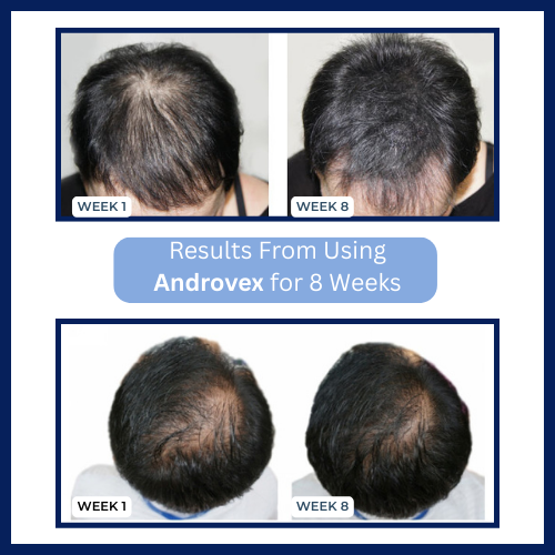 Androvex™ Copper Peptide Hair Growth Formula