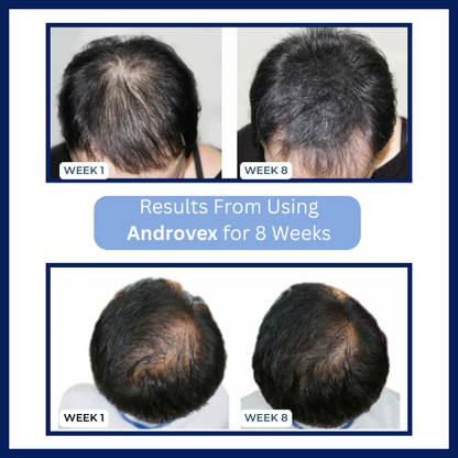 Androvex™ Copper Peptide Hair Growth Formula